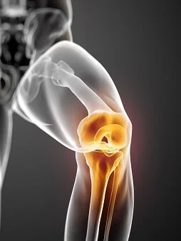 Traumatologo ortopedista especialista en cirugía de rodilla en guadalajara